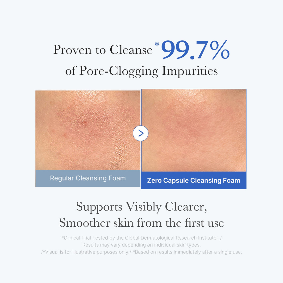 Medicube Zero Pore Clearing Capsule Cleansing Foam veido prausiklis, 120 ml – papildomas gamintojo vaizdas