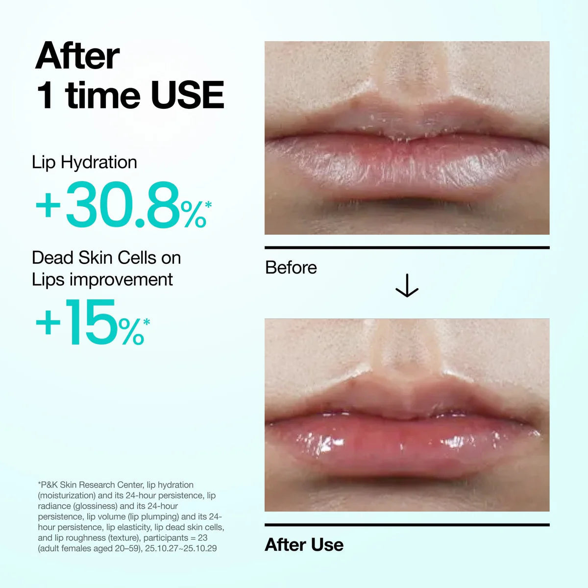 Anua – Siero labbra PDRN, 10ml